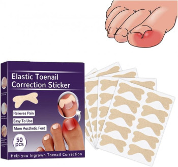 Набор пластырей Elastic Toenail Correction Sticker для коррекции и устранения вросших ногтей 50 шт 207402